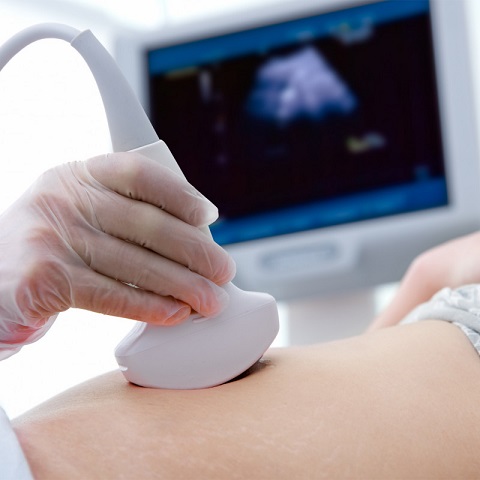 Ultrahang-diagnosztika